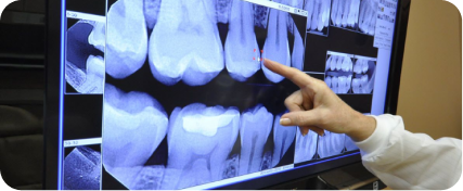 Digital dental X-ray and imaging