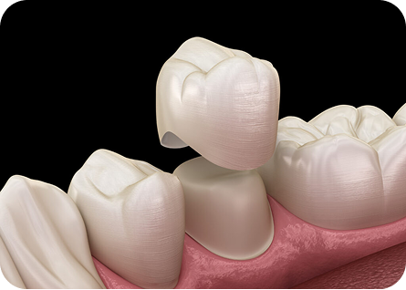 Restorative Dentistry